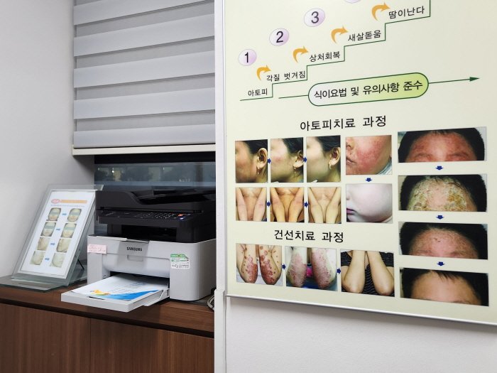 한포진 습진 한의원 추천